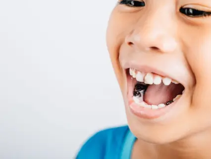 webp/Pediatric-Root-Canal-Treatment-for-Kids-Row-1-Kid-Grins.webphfazwz.webp