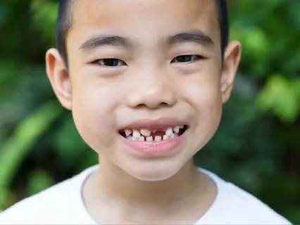Why Broken Baby Teeth Are a Dental Emergency - Kid Grins Why Broken Baby Teeth Are a Dental Emergency - Kid Grins